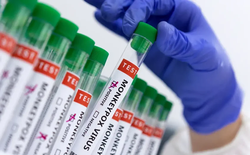 Mpox: OMS pede a fabricantes que submetam vacinas para uso emergencial em meio a 'surto grave e crescente' por nova cepa