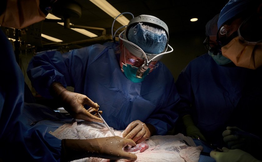 Em experimento de sucesso, rim de porco funciona perfeitamente em corpo humano por 2 meses e aumenta esperança para transplantes