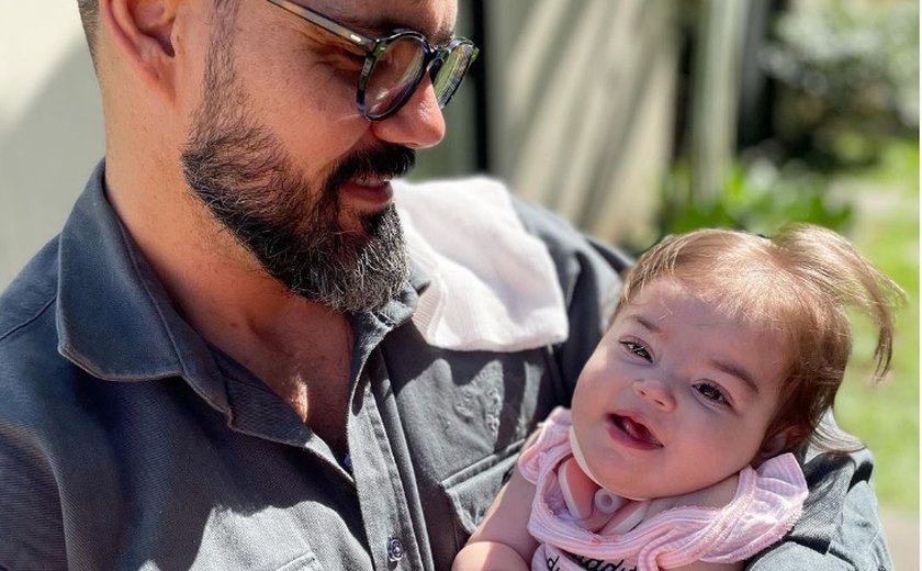 Filha caçula do ator Juliano Cazarré passa por nova cirurgia