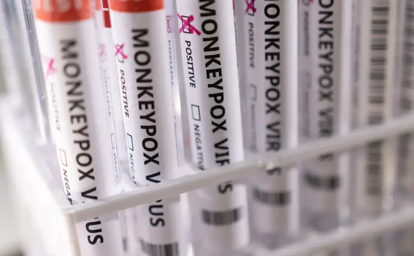 OMS declara Mpox uma emergência de saúde internacional, em meio ao avanço da doença na África