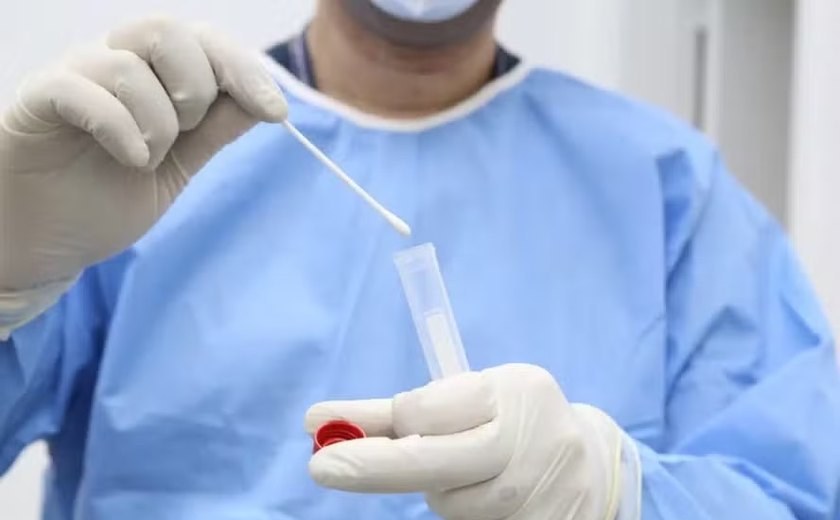 Suécia confirma primeiro caso de variante da Mpox fora da África