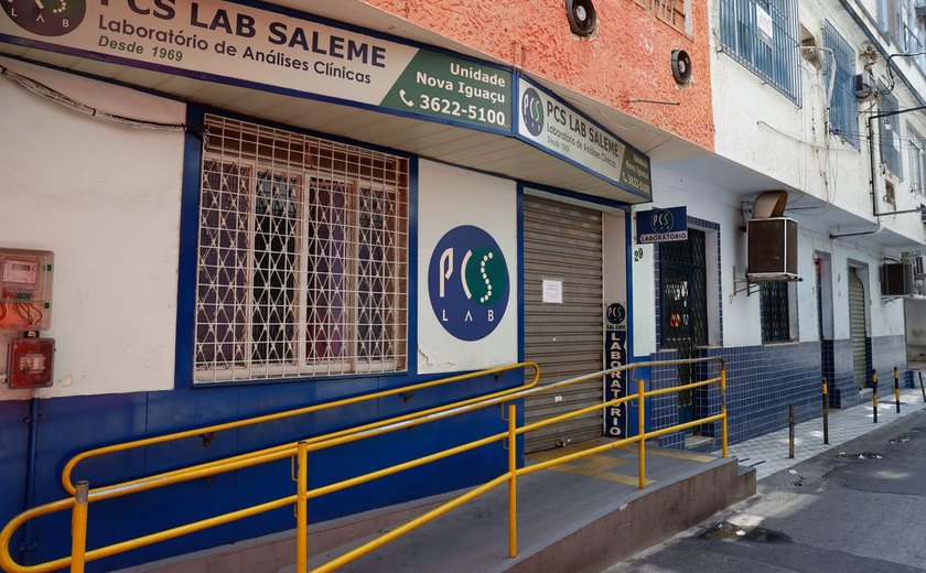 HIV: falha no controle de exames pode ter prejudicado resultados
