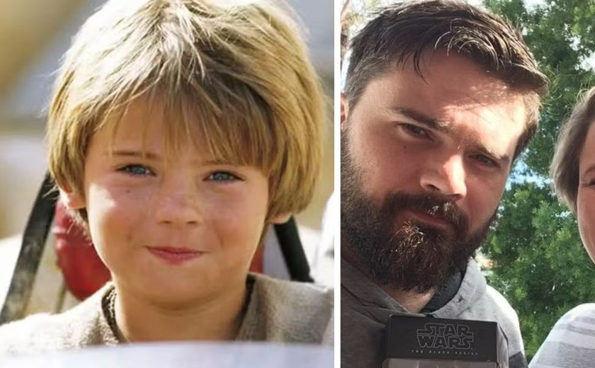 Ator que interpretou Jovem Anakin em 'Star Wars' é internado após sofrer surto psicótico, nos EUA