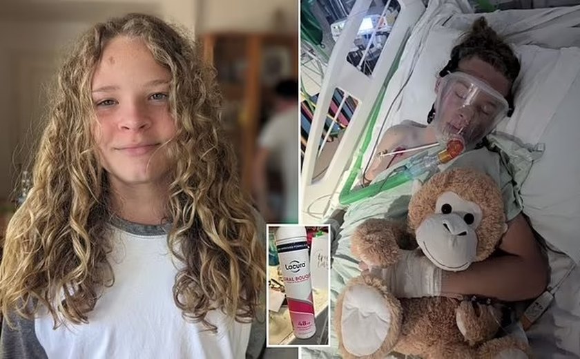 Menino de 12 anos sofre parada cardíaca e convulsões após seguir 'trend' de inalação com desodorante; entenda o caso
