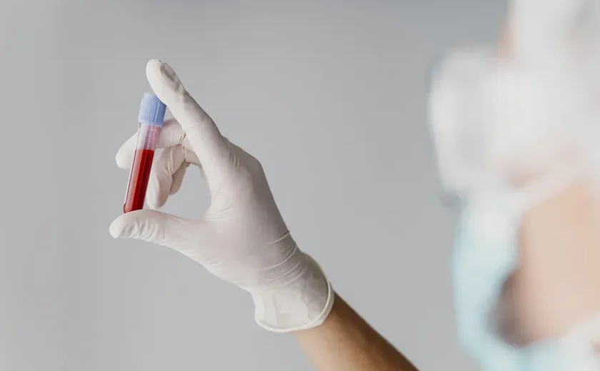 Alzheimer: cientistas criam teste de sangue caseiro que pode detectar a doença; entenda