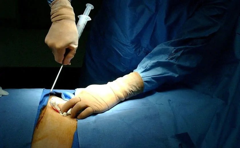 CSE participa de campanha de doação de medula óssea