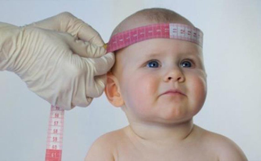 Ministério da Saúde divulga dados atualizados de microcefalia