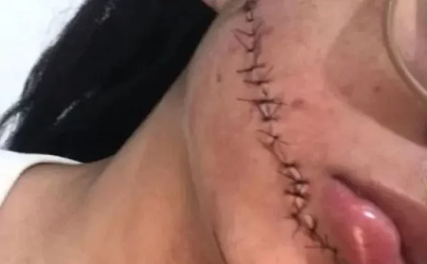Jovem tem rosto esfaqueado em ônibus
