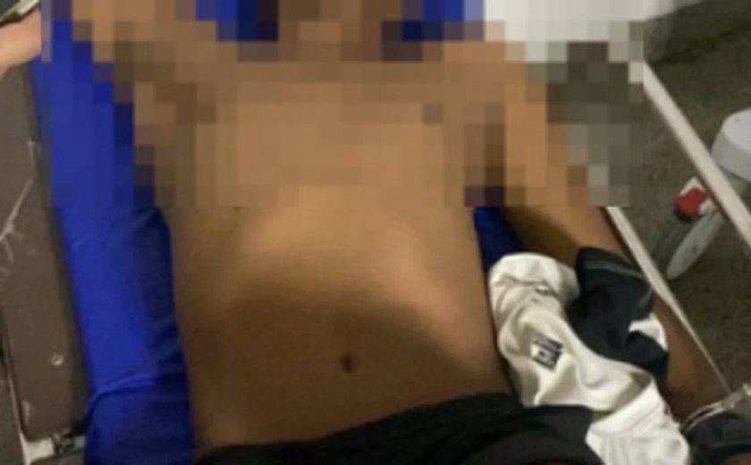 Suspeito de participar do assassinato do sargento reformado dá entrada no HGE com um tiro na perna