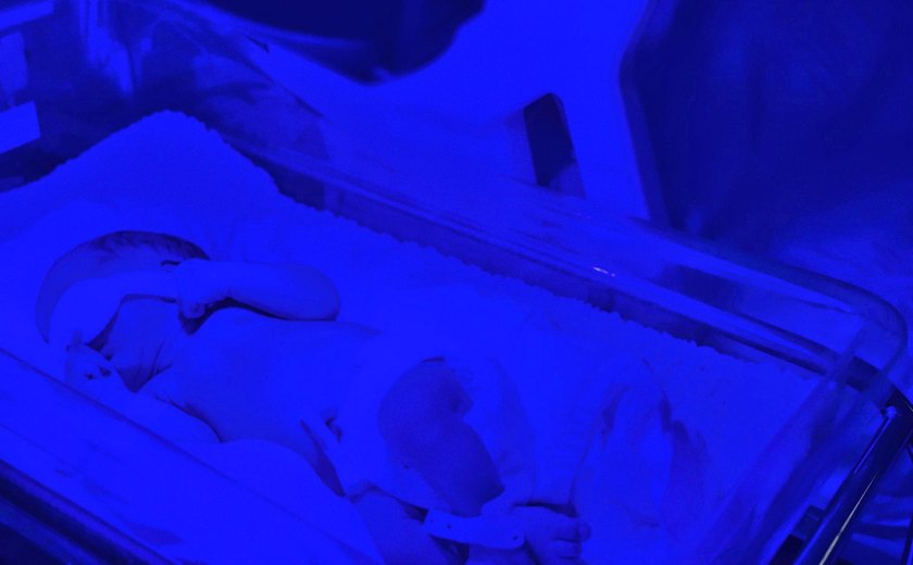Pediatra reforça importância da fototerapia para tratamento de icterícia em recém-nascidos