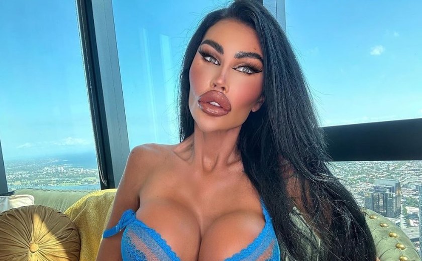 Barbies humanas gastam fortuna para se parecerem com boneca e visual impressiona