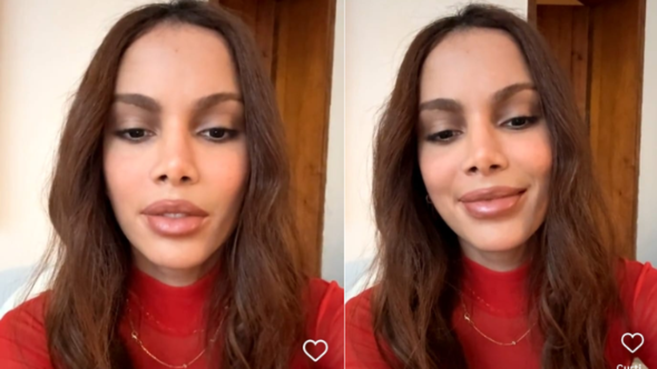 Anitta desabafa e fala pela primeira vez sobre novos procedimentos estéticos: 'o corpo é meu'