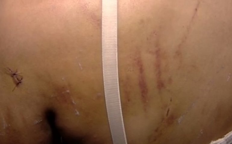 Mãe de garota torturada diz que não perdoa menores por ato: ‘Desumano’