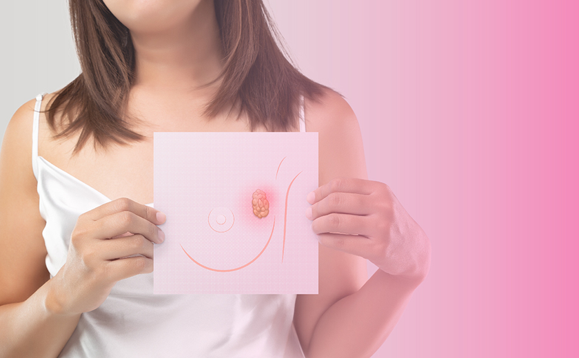 Estudo britânico: mulheres com mais de 50 anos e Câncer de Mama em fase inicial podem reduzir periodicidade da mamografia com segurança