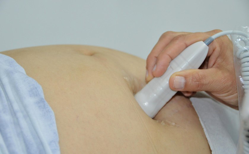 Secretaria de Estado da Saúde abre inscrições para o IX Fórum Perinatal de Alagoas de 2024