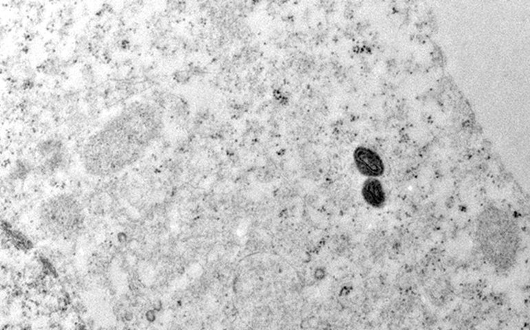 Argentina descarta mpox em tripulante de navio que saiu do Brasil