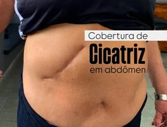 CICATRIZES E ARTE (8).jpeg 