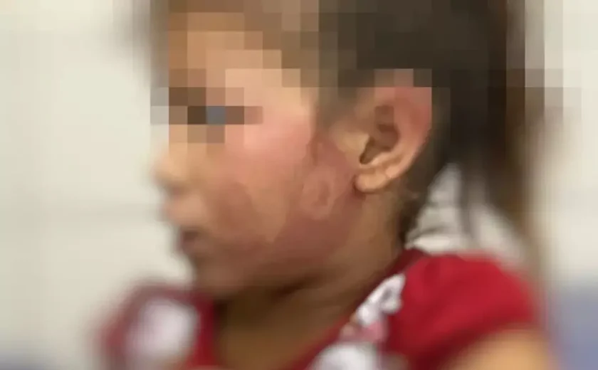 Homem é preso após criança denunciar agressão em escola de Taquarana