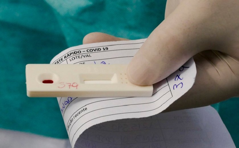 Ministério da Saúde anuncia a aquisição de 46 milhões de testes para diagnóstico da Covid-19