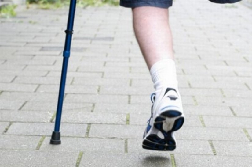 Acidentes de moto são a maior causa das amputações na Unidade do Agreste