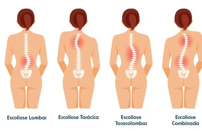 O que é e por que o School Screening começa a ganhar espaço nas escolas e clínicas do país