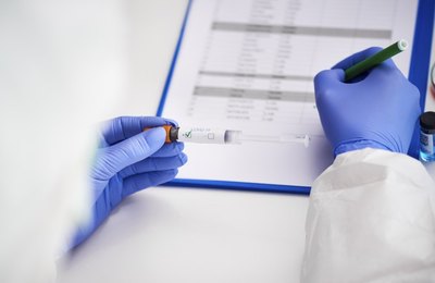 ANS inclui teste sorológico de covid-19 em rol de cobertura obrigatória