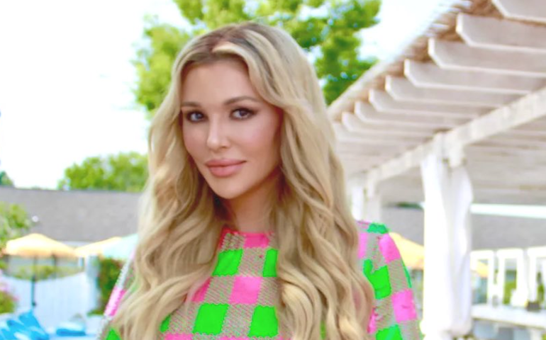 Com 'rosto derretido', Brandi Glanville passará por cirurgia; entenda