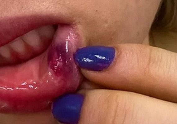 PC ﻿investiga piloto aviador denunciado por dar socos em mulher