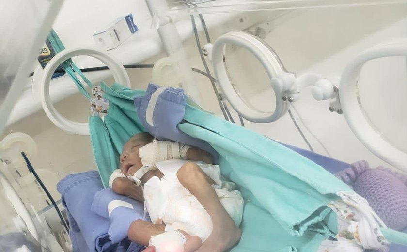 Bebês prematuros de Hospital em Arapiraca descansam em redes