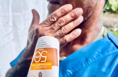 Médico do Hospital Ib Gatto destaca importância do diagnóstico precoce do câncer de pele