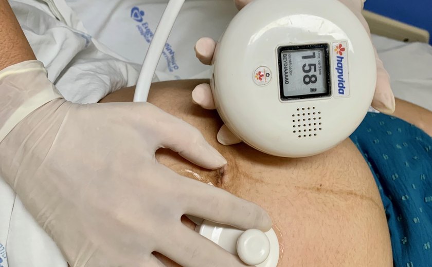 Hapvida NotreDame Intermédica e Senai Ceará lançam detector de frequência cardíaca fetal com Inteligência Artificial