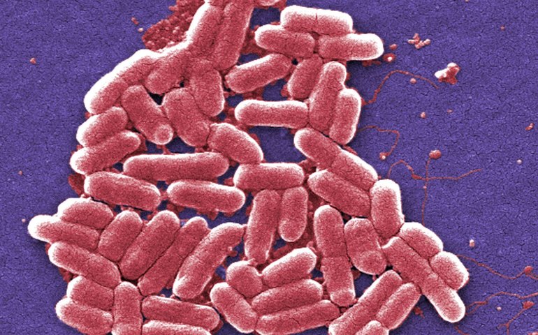 Superbactérias podem causar até 40 milhões de mortes nos próximos 25 anos, estima especialista