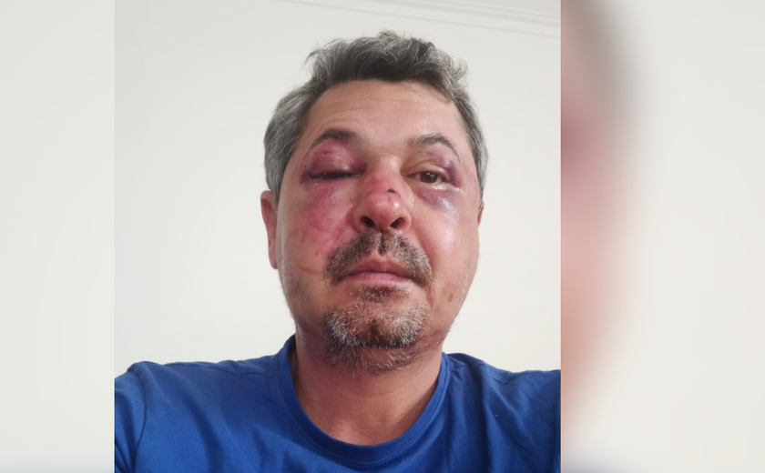 Pernambucano é espancado em Portugal: Agressor perguntou se ele era brasileiro antes de começar a bater