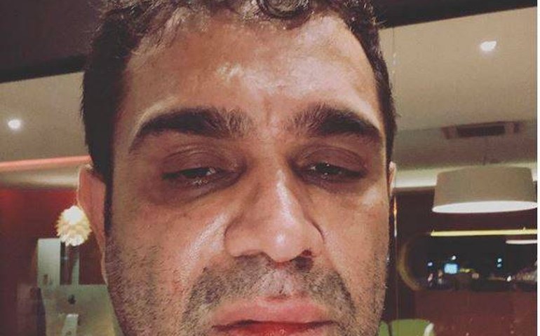 Evandro Santo, ex-&#8216;Pânico&#8217;, assume vício em drogas: &#8216;Saindo do armário&#8217;