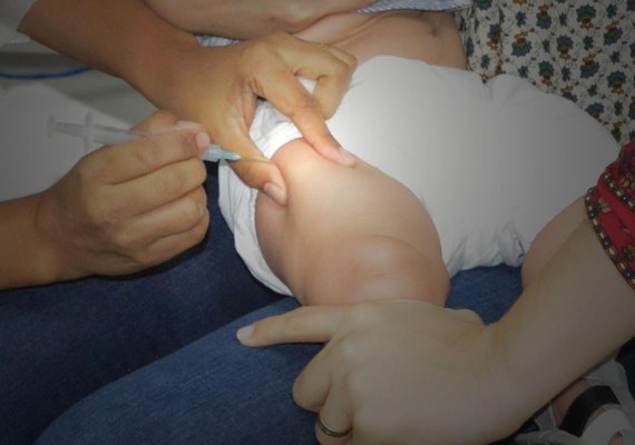 Sesau orienta sobre o esquema vacinal para prevenir a catapora