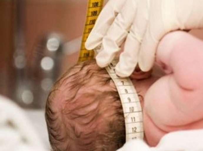 Maceió: 24 casos de microcefalia podem ter relação com zika vírus