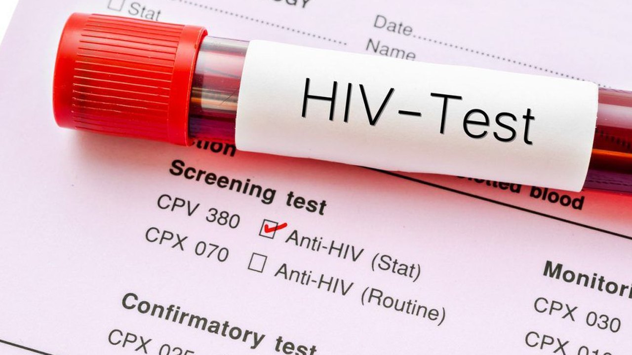 Pandemia provoca redução de consultas e exames de HIV