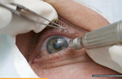 Abril Marrom alerta sobre doenças que podem levar à cegueira