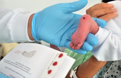 Dia do Teste do Pezinho: Pediatra da Sesau ressalta a importância do exame para diagnosticar doenças precocemente