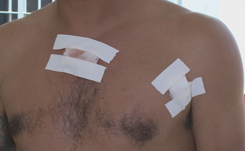 Agente de trânsito atira no peito de homem após discussão fútil