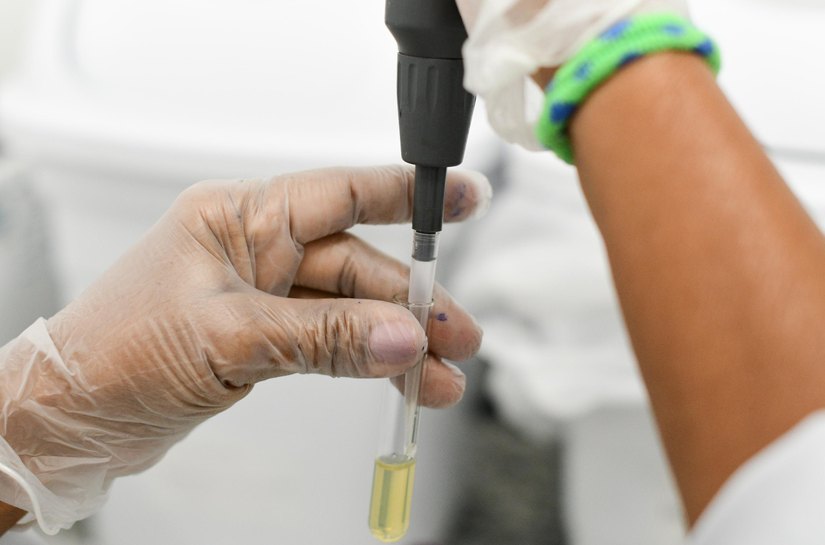 Quase 300 hemofílicos têm acesso a assistência integral do Hemocentro de Alagoas