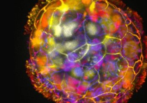 Cientistas constroem robôs com função curativa usando células humanas