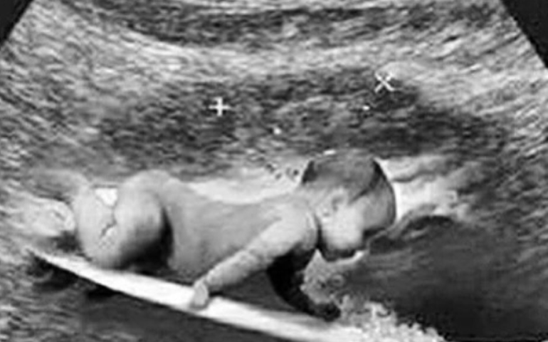 Gabriel Medina anuncia gravidez da namorada, Isabella Arantes