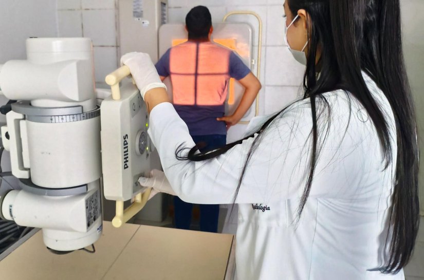 Hospital Helvio Auto intensifica ações de prevenção no Dia Mundial de combate à Tuberculose