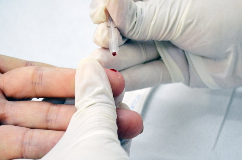 Helvio Auto fará testes para detectar HIV e sífilis abertos à população