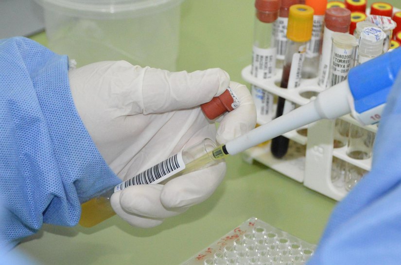 Com 7 casos este ano em Alagoas, Sesau reforça medidas de prevenção contra meningite