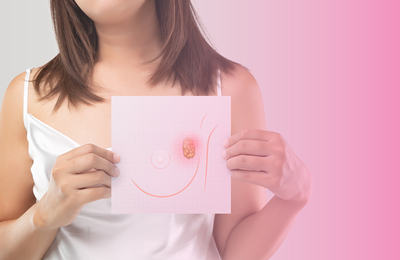 Conheça os 3 tipos de câncer mais comuns nas mulheres