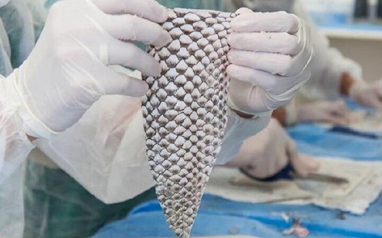 Técnica brasileira com pele de tilápia avança no tratamento de queimaduras