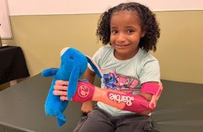 Novo centro de impressão 3D do INTO reduz tempo de produção de próteses e amplia acesso à reabilitação