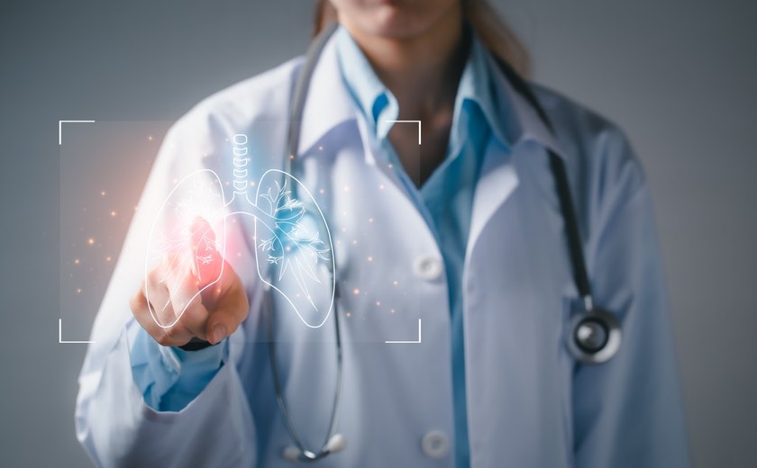 Proteína HMGN1 Pode melhorar eficácia da Quimioterapia contra Câncer de Pulmão.